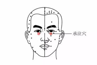 承泣穴的具体位置 按摩能够养生