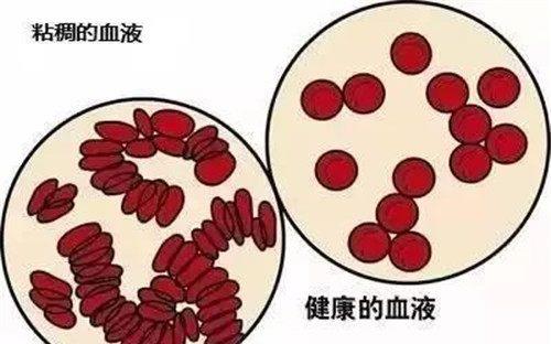 黏稠的拼音怎么读音，黏稠的反义词