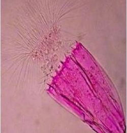 什么是后生生物?