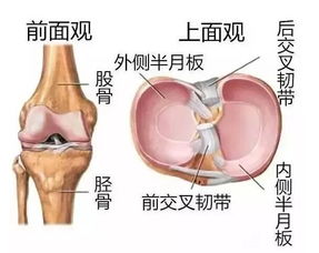 半月板撕裂保守治疗可以完全恢复吗，半月板撕裂可以自己恢复吗