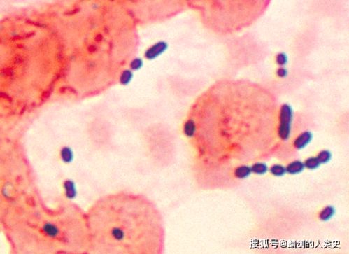 按细胞壁的特性将原核生物分为哪四类