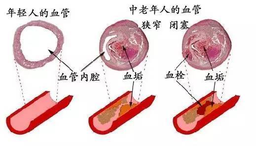 血管读音是什么