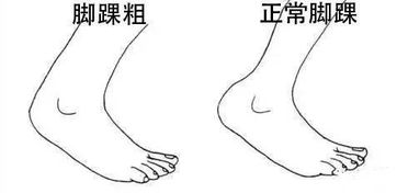 ankle是什么意思中文