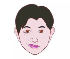 面部痉挛的早期症状?