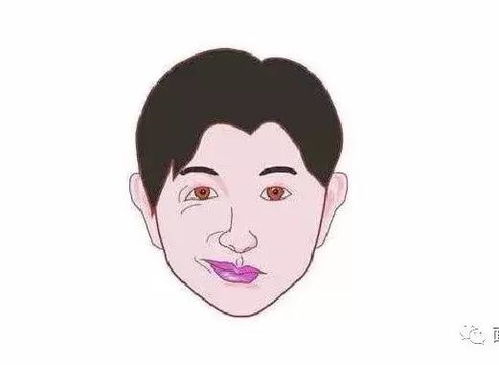 面部痉挛微创手术多少钱，面部痉挛手术