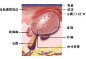 正常菌群的生理作用，正常菌群的有益作用不包括