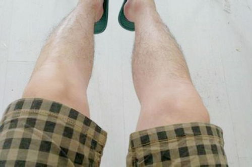 腿毛太多怎么办男生，腿毛可以刮吗?
