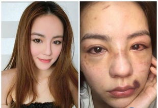 winkies读音，winkie是什么意思