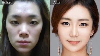 面颊凹陷，面颊抽搐怎么回事