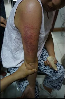 “胳膊”的拼音是什么?