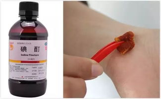 碘酊可以直接擦伤口吗，碘酊不脱碘会怎样