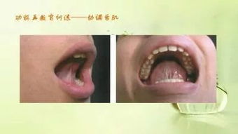 想当口腔正畸医生,请问大学该读什么专业?请详细讲下从大学开始到当上