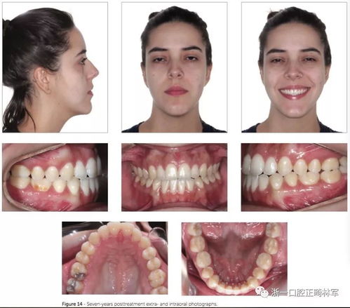 口腔正畸怎么读，畸怎么读