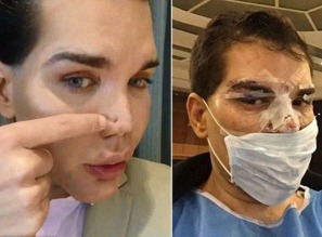 古代刑罚割掉鼻子之后怎么呼吸?受刑人如何生存?