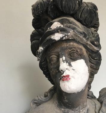 circumcision 翻译，circumcision stapler