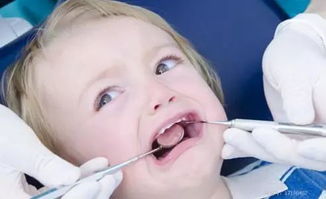 龋齿读音，龋齿图片