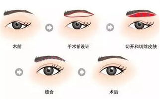 切眉和提眉的区别是什么