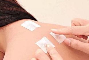 天灸的作用与功效，天灸的位置