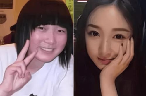 比照工伤的认定标准，比照片