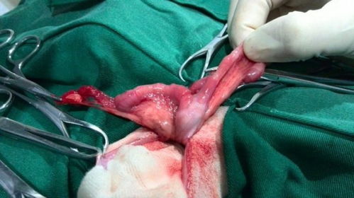 节育手术费用大概多少，节育手术有几种方式