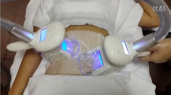 什么是冷冻溶脂?