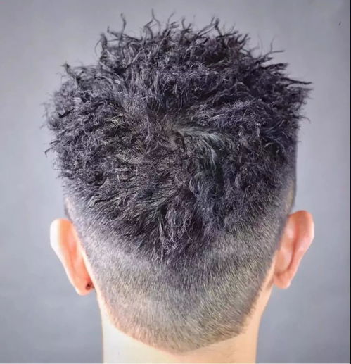 少白头能治好吗 目前，少白头是缺什么元素