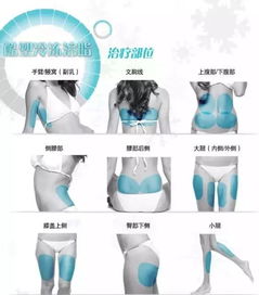 冷冻溶脂的副作用和危害，冷冻溶脂机器价格