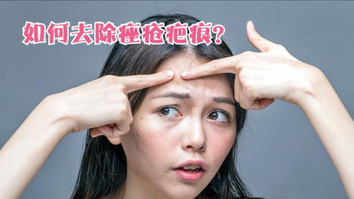 疮疤的拼音是什么?