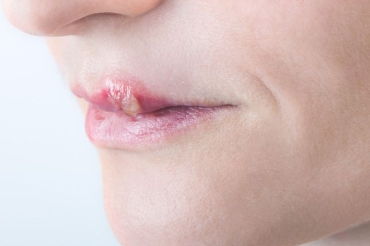 唇亡齿寒是什么意思