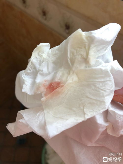 一点血是不是大姨妈，一点血的别名