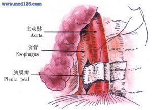 esophagus翻译，Esophagus杂志