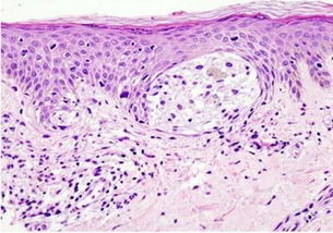 黑色素详细资料大全