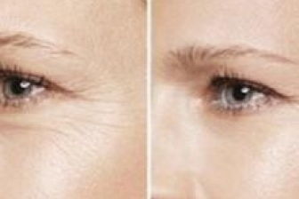 眼睛的词语有哪些?