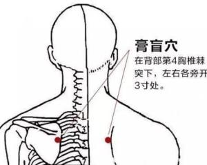 “膏肓”怎么读?