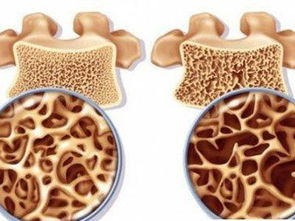 疏松结缔组织中的纤维有哪三种，疏松结缔组织的特点是