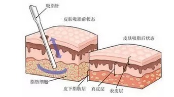 肪的组词大全(约50个) 肪的词语解释_肪是什么意思?