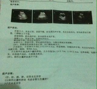 “赘”是什么意思?