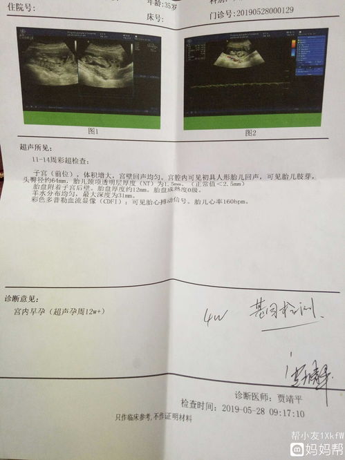 周后和小周后，周后商青君