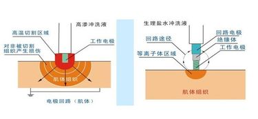 属于等渗,低渗,高渗的液体都有哪些?