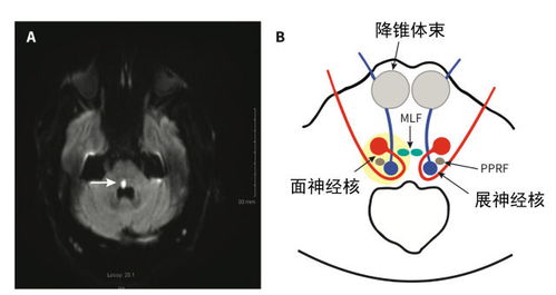 medial middle两个词的区别,谢谢