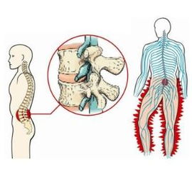 神经疼有什么好办法缓解，神经疼痛的症状表现