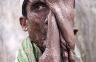 怪胎英文怎么说，怪胎英文表达