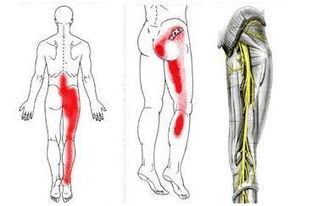 手神经痛是什么症状?