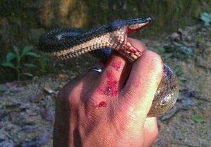 梦见被蛇咬伤了脚是什么意思，梦见被蛇咬伤手指是什么意思