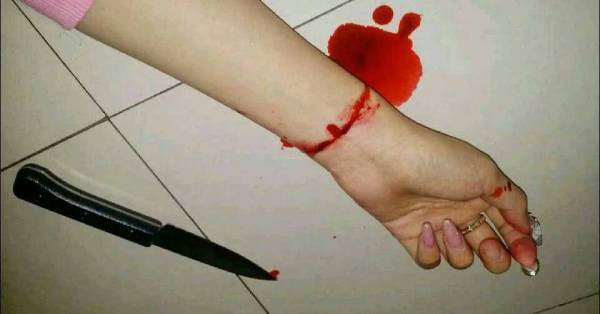 自残照片 女生 轻微 手臂，自残照片真实