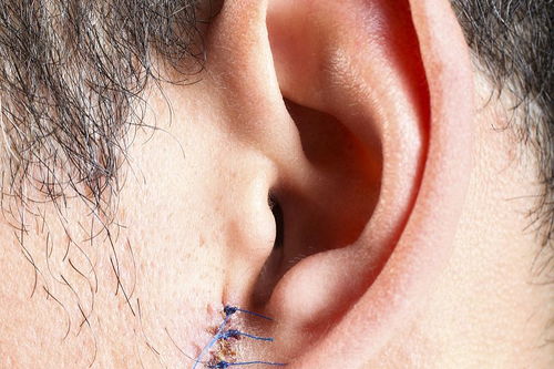 一个丽一个耳朵旁什么字，一个丽一个右耳旁