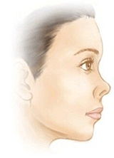 鼻子朝天嘴巴朝地.敲它一锤，鼻子朝天怎么改善