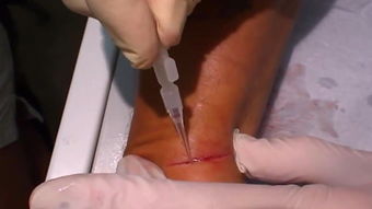 疤字跟什么有关