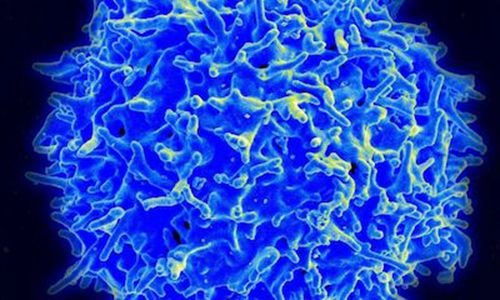 CD4+T细胞是什么细胞，t细胞的作用有哪些