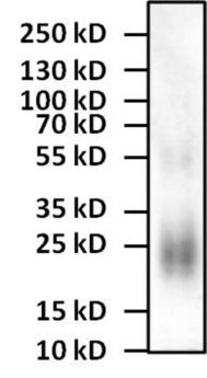 connective tissue，connectives of concession